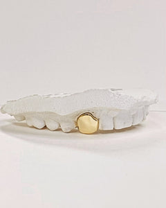 One tooth capped in 9kt gold, your design of choice
