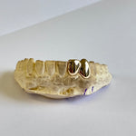 Load image into Gallery viewer, Two teeth in 9kt Gold
