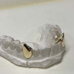 Load image into Gallery viewer, Two teeth capped in 9kt gold, your design of choice
