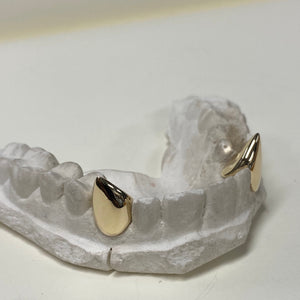 Two teeth capped in 9kt gold, your design of choice