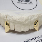 Load image into Gallery viewer, Two teeth capped in 9kt gold, your design of choice
