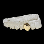 Load image into Gallery viewer, One tooth capped in 9kt gold, your design of choice
